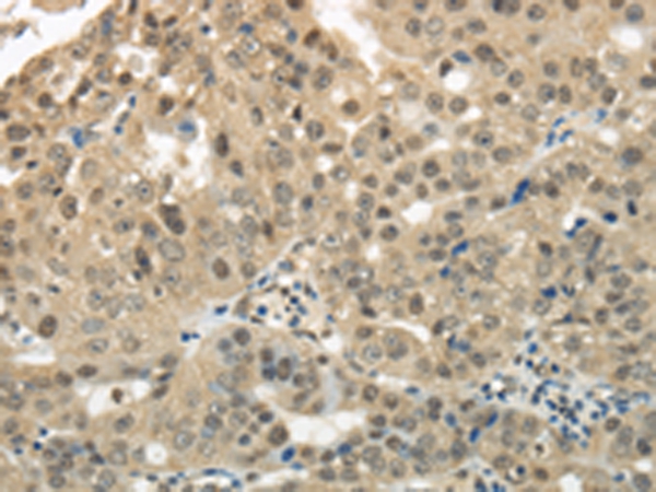 KEAP1 Antibody