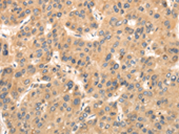 TTC23 Antibody