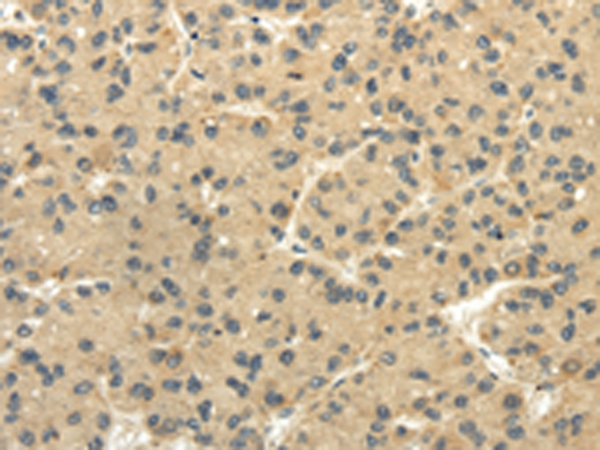TULP2 Antibody