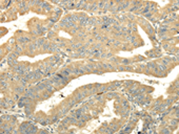 TULP2 Antibody