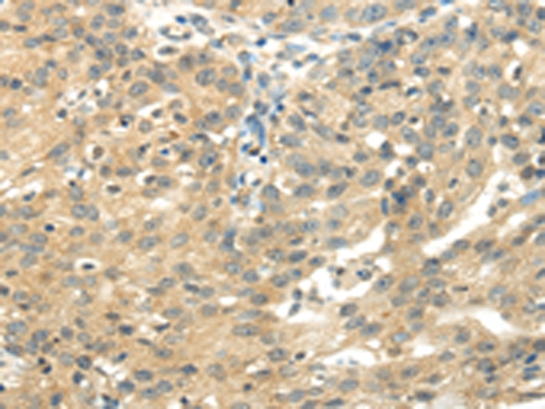 UBAP2L Antibody