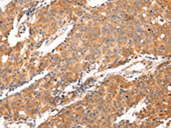 MAP2 Antibody