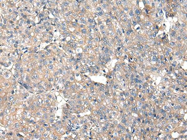 ITGA5 Antibody