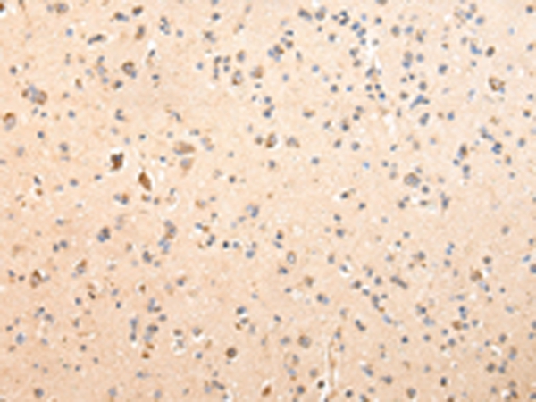 SDCBP Antibody