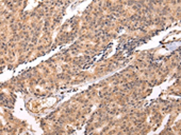 SWAP70 Antibody