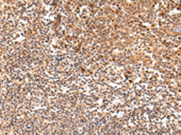 SWAP70 Antibody