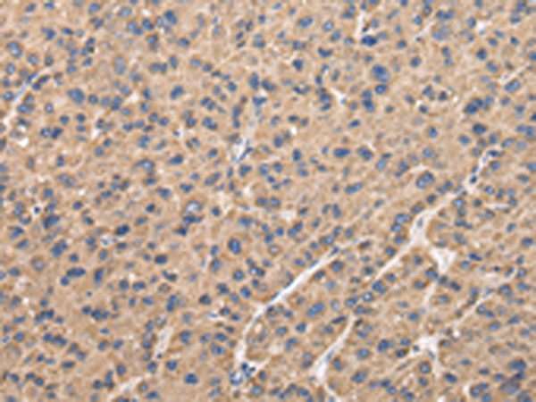 UQCRC1 Antibody
