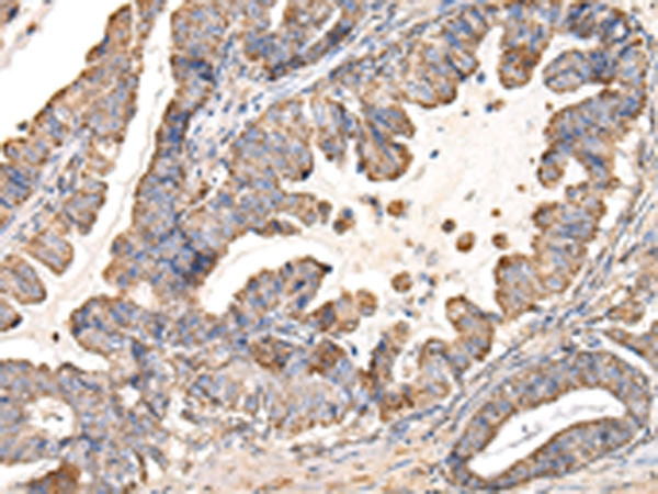 UQCRC1 Antibody