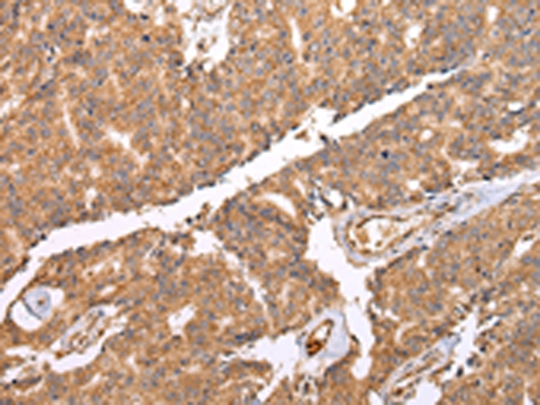 UQCRC2 Antibody
