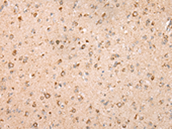 UQCRC2 Antibody