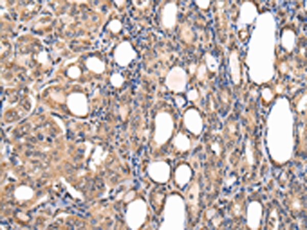 USF1 Antibody
