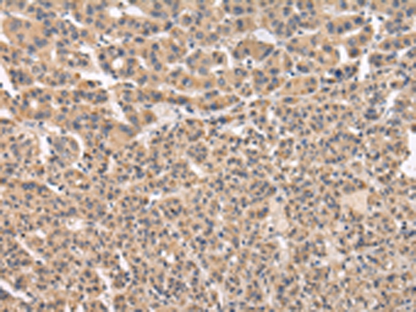 VPS41 Antibody