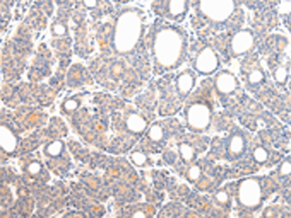 VPS54 Antibody