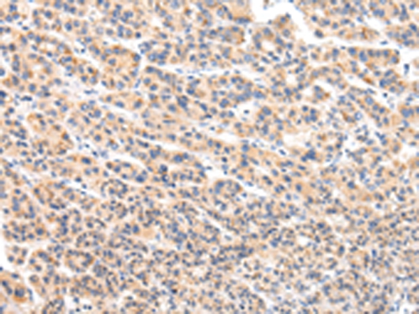 VPS54 Antibody