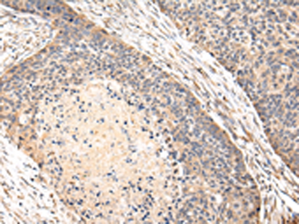 VPS35 Antibody