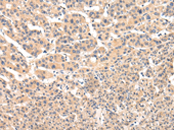 VPS33B Antibody