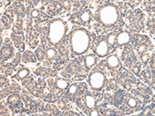 VPS37D Antibody