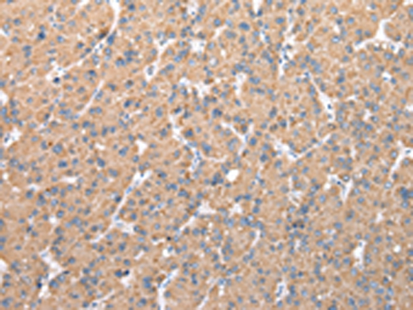CFAP52 Antibody