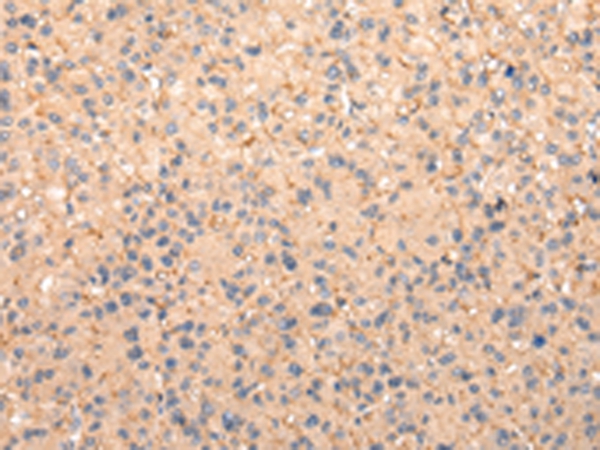 ZFAND1 Antibody