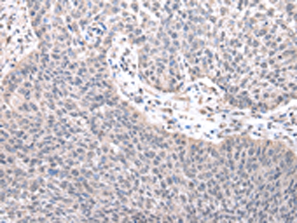 ZNF239 Antibody