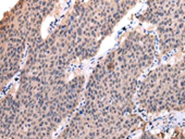 POLR2K Antibody