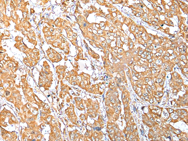 NDUFB10 Antibody