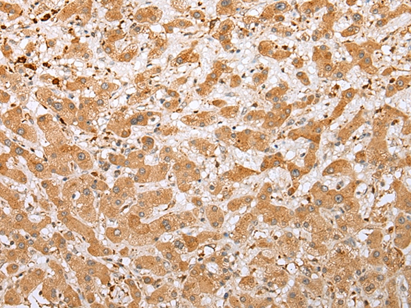 NDUFB3 Antibody