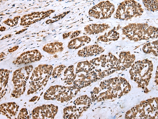HIF1A Antibody