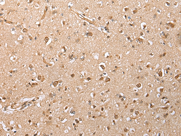 HIF1A Antibody
