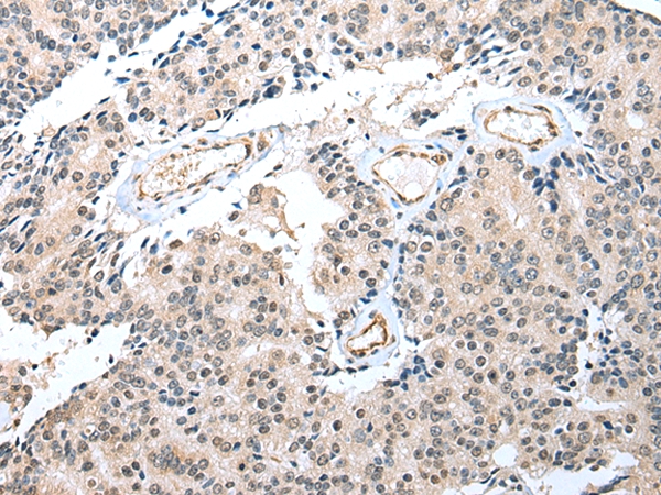 S100A16 Antibody