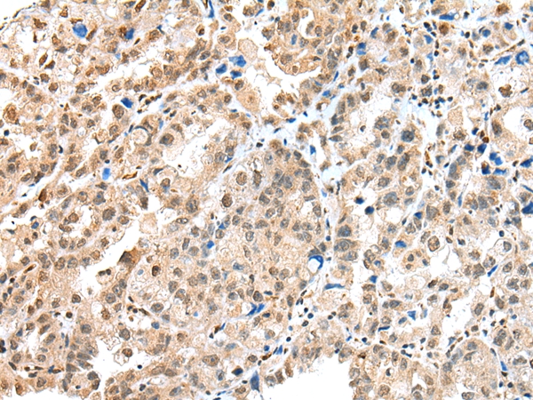 S100A16 Antibody