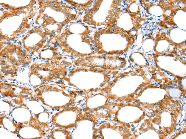 ERMP1 Antibody