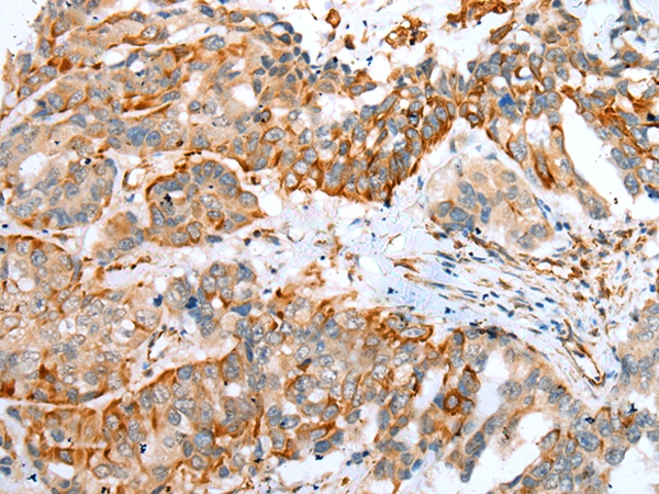 MYBPHL Antibody