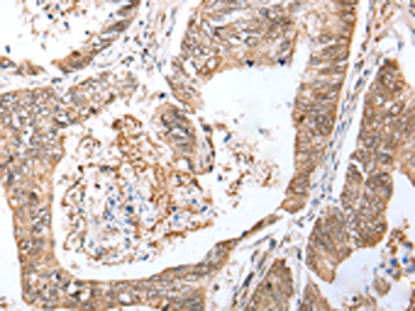 LRRC19 Antibody