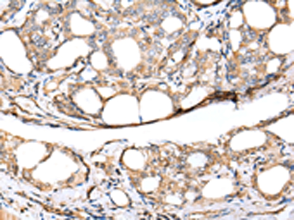 KCTD16 Antibody