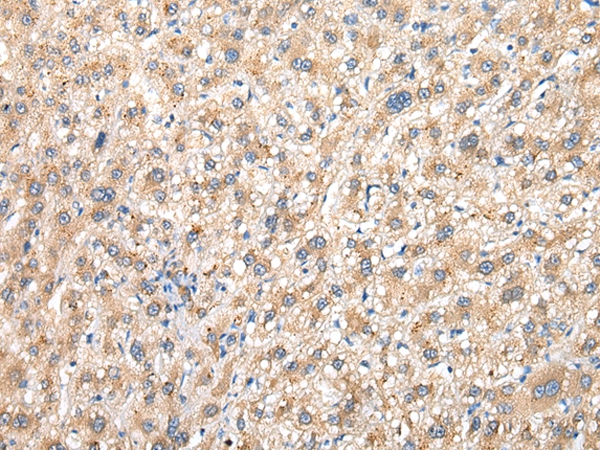 PRG3 Antibody