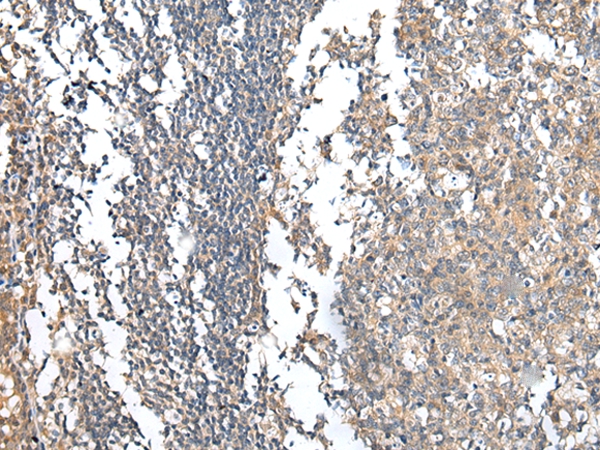 PRG3 Antibody