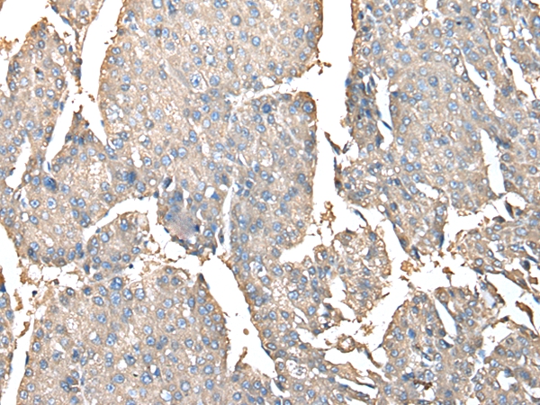 PRSS38 Antibody