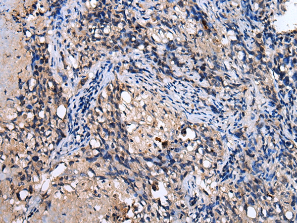 RAB41 Antibody