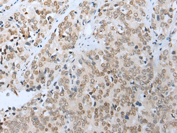 COMMD6 Antibody