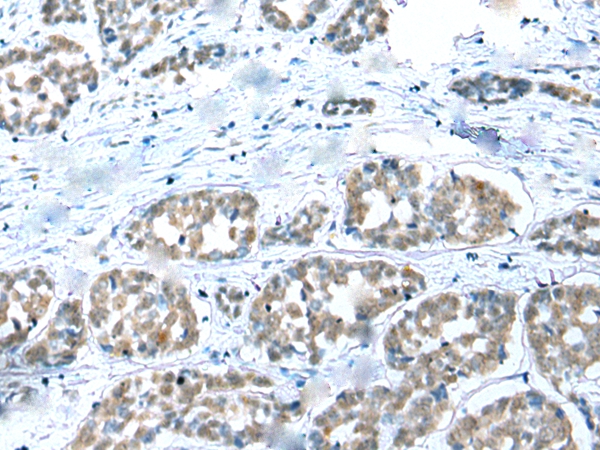 COMMD6 Antibody