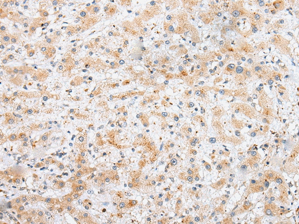 SYCE3 Antibody