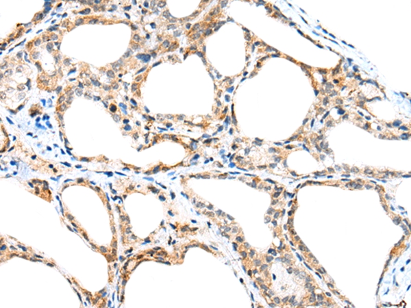SPACA3 Antibody