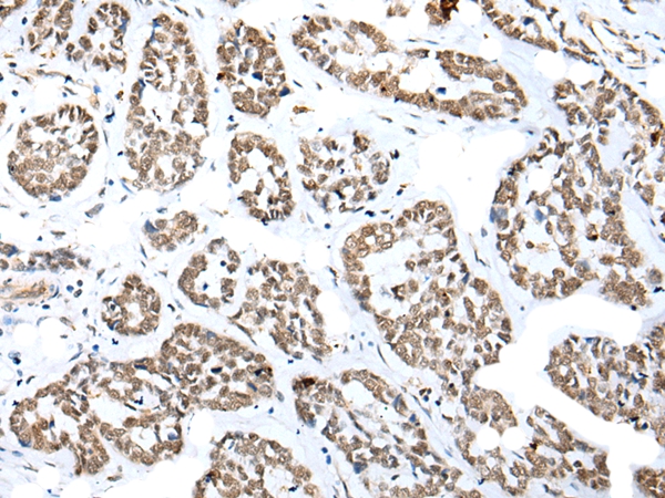 NUDT21 Antibody