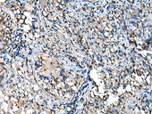 TPPP Antibody