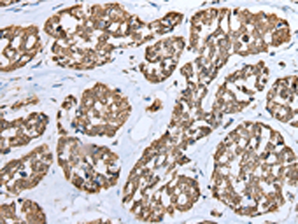TPPP Antibody