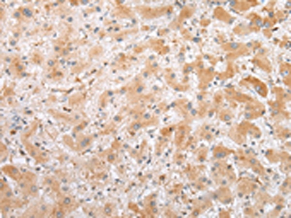 C1QTNF3 Antibody