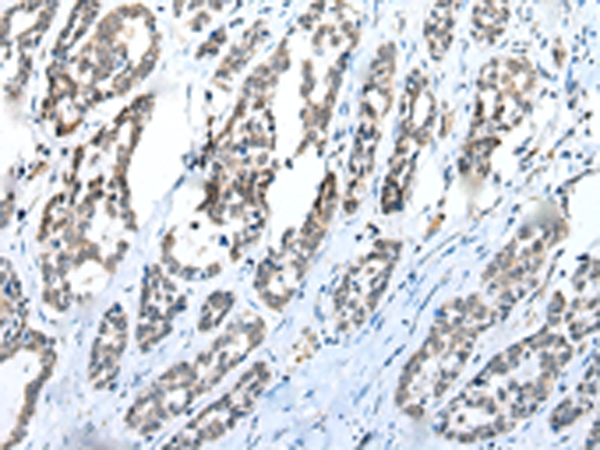 C1QTNF3 Antibody