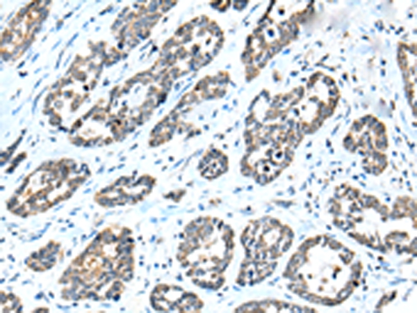 NPL Antibody