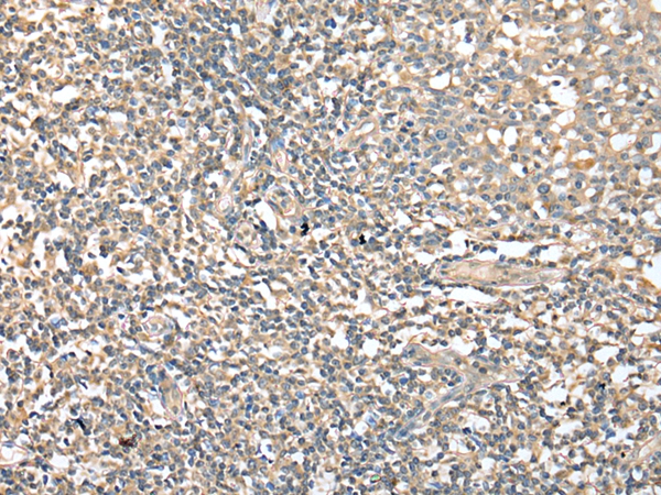 CD1D Antibody